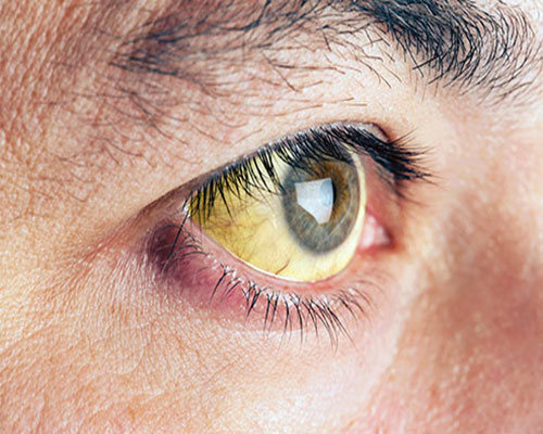 Đôi mắt nói điều gì về sức khoẻ của bạn