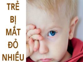 8 câu hỏi thường gặp về đau mắt đỏ