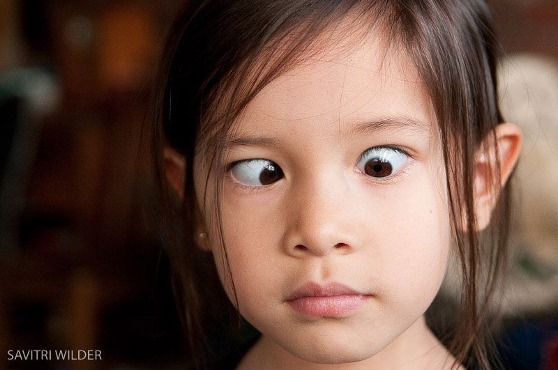 Bệnh về mắt ở trẻ em thường gặp nhất