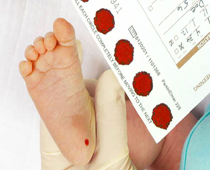 Lấy máu gót chân cho trẻ sơ sinh để làm gì?