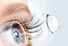 Review mổ mắt Phakic ICL Bệnh Viện Mắt Quốc Tế Nhật Bản