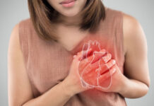 Nhồi máu cơ tim Nguyên nhân, triệu chứng và phòng ngừa