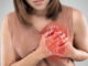 Nhồi máu cơ tim Nguyên nhân, triệu chứng và phòng ngừa
